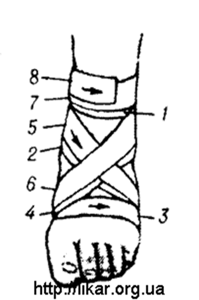 Восьмиобразная повязка на голеностопный сустав техника. Технику наложения восьмиобразной повязки на голеностопный сустав.. Восьмиобразная повязка на стопу алгоритм. Алгоритм восьмиобразной повязки на голеностопный сустав.