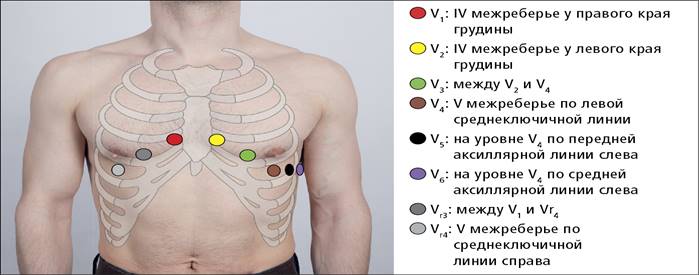 Стандартная электрокардиограмма - Электрокардиография - Функциональные  исследования - Исследования - Внутренняя Mедицина