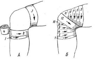 Повязка на локоть схема
