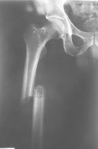 http://weborto.net:8080/pipermail/ortho/attachments/20140729/1d117a65/attachment-0002.jpg