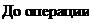 Надпись: До операции 
