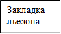 Закладка льезона