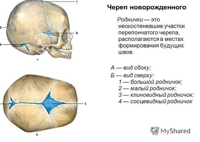 Размер родничка норма. Роднички черепа новорожденного. Роднички и швы у новорожденного. Родничок у новорожденных. Швы и роднички черепа.