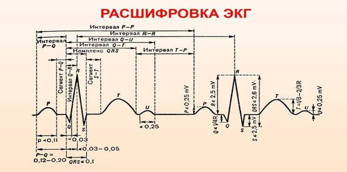 Как расшифровывают ЭКГ, какие показатели имеют значение