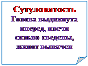 Rectangle: Folded Corner: Сутуловатость
Голова выдвинута вперед, плечи сильно сведены, живот выпячен
