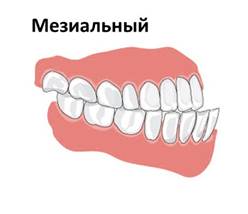 http://zub4.ru/wp-content/uploads/2017/11/nepravilnyiy-prikus-e1513068709366.png