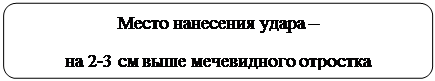 Скругленный прямоугольник: Место нанесения удара – 
на 2-3 см выше мечевидного отростка
