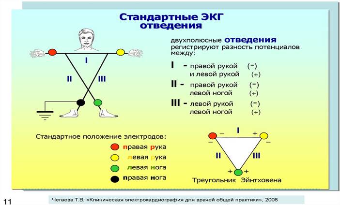 Инструментальные методы исследования в работе врача общей практики  (семейного врача). Электрокардиография. Нормальная ЭКГ - презентация онлайн