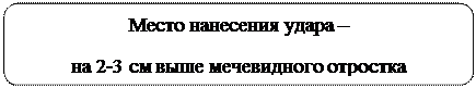 Скругленный прямоугольник: Место нанесения удара – 
на 2-3 см выше мечевидного отростка
