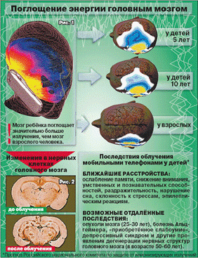 Влияние мобильных телефонов на мозг человека