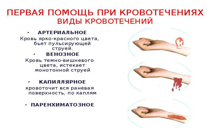 https://krovotechenie.ru/wp-content/uploads/2018/12/3079f5cd2106e22d71e6605cdbed28c5.jpg