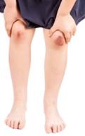 https://corium21.com/wp-content/uploads/2013/10/Skin-Abrasion.jpg