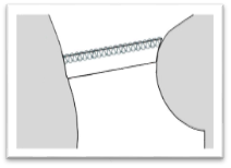 11a zautyuzhivanie srezov plechevogo shwa2