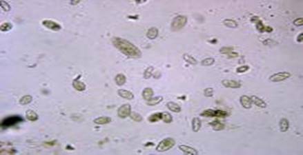 Инфузории туфельки