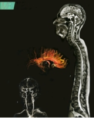 https://www.zdrav.kz/images/diagnostics/diagnostics_pic17.png