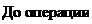 Надпись: До операции 