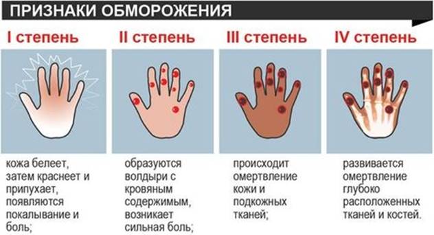 http://kozhica.ru/wp-content/uploads/2016/11/bmorojenie.jpg