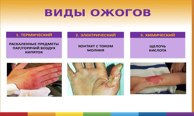 https://cf.ppt-online.org/files/slide/o/o4UCLyTBls3qVfXxDz7wpYEr1tGudeOiQcFHhR/slide-119.jpg