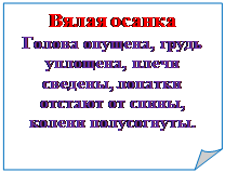 Rectangle: Folded Corner: Вялая осанка
Голова опущена, грудь уплощена, плечи  сведены, лопатки отстают от спины, колени полусогнуты.

