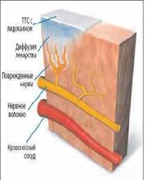 Описание: https://present5.com/presentation/3/16065293_108234691.pdf-img/16065293_108234691.pdf-21.jpg