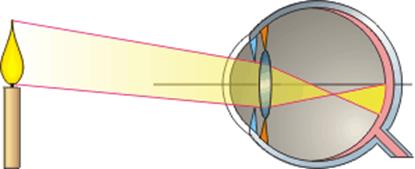 Регулирует поток света попадающего на сетчатку. Преломление световых лучей в глазу. Преломление лучей на сетчатку. Преломление лучшей в глазе. Преломление света в сетчатке глаза.