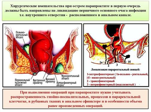 https://hemor.ru/wp-content/uploads/2020/12/img_16079894994642-1-1024x576.jpg