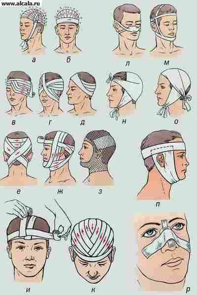 http://alcala.ru/medicinskaya/pictures/0265729161.jpg