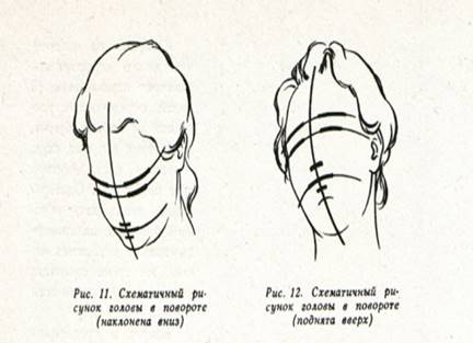 Схема деления головы для афрокос