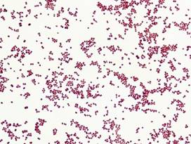 http://imgc.allpostersimages.com/images/P-473-488-90/64/6473/HEQH100Z/posters/gladden-willis-branhamella-catarrhalis-bacteria-a-gram-negative-coccus-gram-stain-lm-x322.jpg