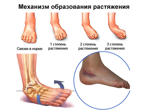 https://www.your-base.info/wp-content/uploads/2019/08/molitva-pri-rastyazhenii-nogi1.jpg
