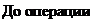 Надпись: До операции 