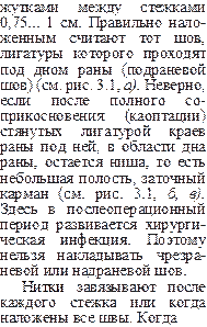 жутками между стежками 0,75... 1 см. Правильно нало¬женным считают тот шов, лигатуры которого проходят под дном раны (подраневой шов) (см. рис. 3.1, а). Невер¬но, если после полного со¬прикосновения (каоптации) стянутых лигатурой краев раны под ней, в области дна раны, остается ниша, то есть небольшая полость, заточный карман (см. рис. 3.1, б, в). Здесь в послеоперационный период развивается хирурги¬ческая инфекция. Поэтому нельзя накладывать чрезра- невой или надраневой шов.
Нитки завязывают после каждого стежка или когда наложены все швы. Когда
