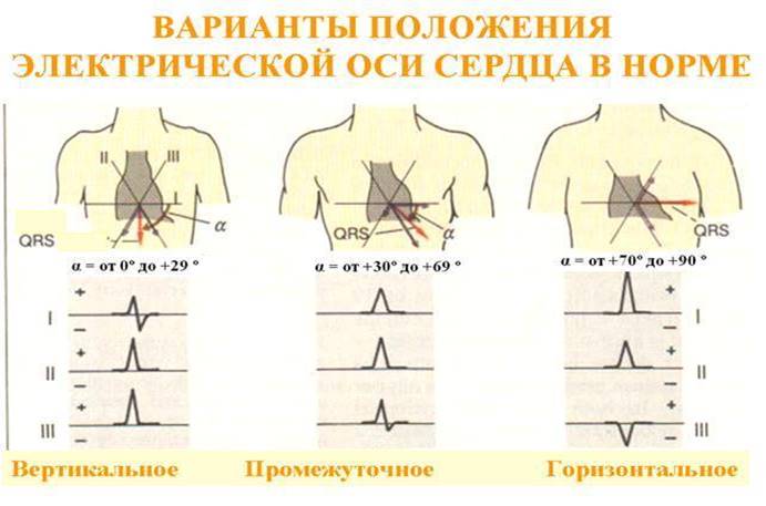 Что показывает и как располагается ЭОС