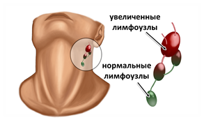 https://fsd.videouroki.net/products/conspekty/bio8/22-limfatichieskaia-sistiema-dvizhieniie-limfy.files/image003.png