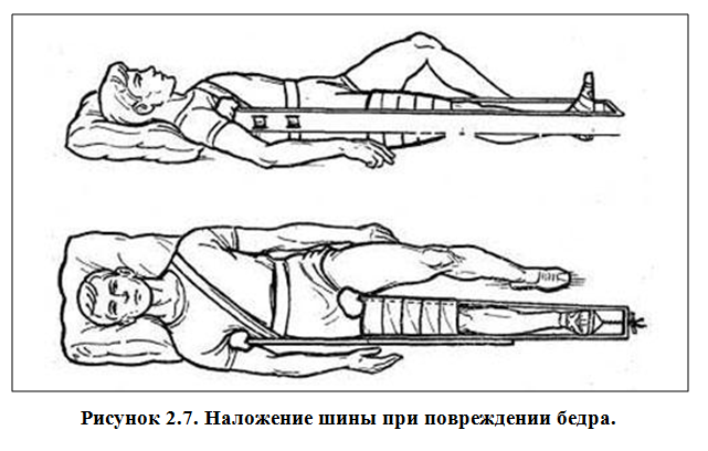 Первая помощь при ранениях и повреждениях
