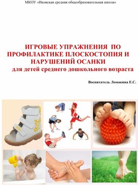 Обложка для материала Комплекс упражнений для профилактики плоскостопия