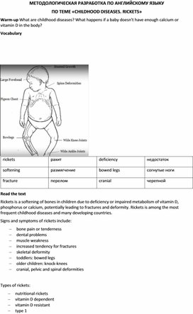 Методологическая разработка по английскому языку по теме «Childhood diseases. Rickets»