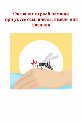 Первая помощь при укусе осы, пчелы, шмеля или шершня