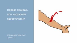 Первая помощь при наружном кровотечении