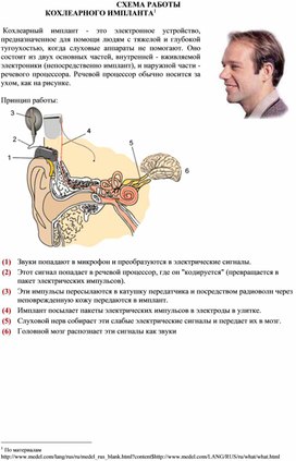 Замена речевого процессора кохлеарного импланта