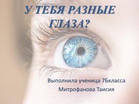 Обложка для материала Презентация к проекту « У тебя разные глаза?»