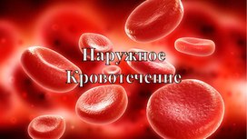 Обложка для материала Наружное кровотечение.
