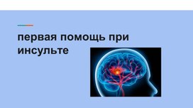 Обложка для материала Первая помощь при инсульте.
