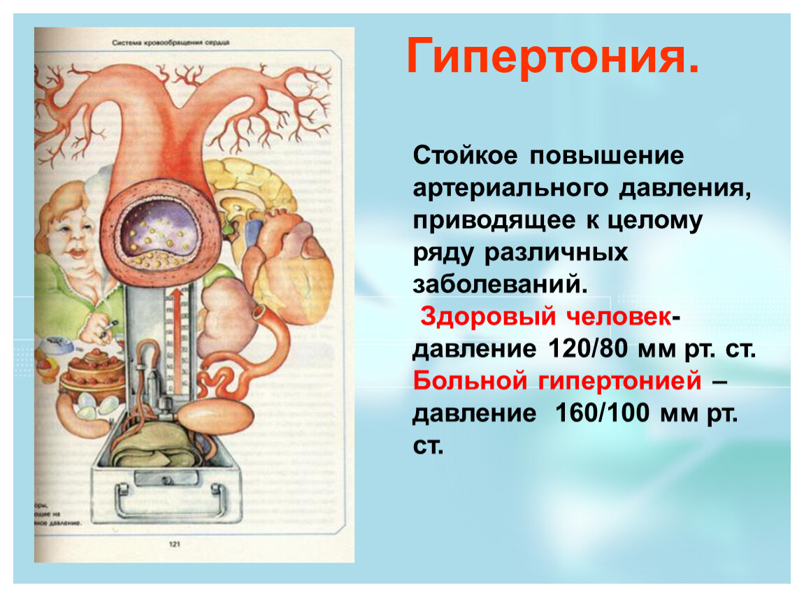 К чему может привести высокое давление. Гипертония. Стойкое повышение артериального давления у человека. Механизм высокого кровяного давления. Стойкое повышение кровяного давления.