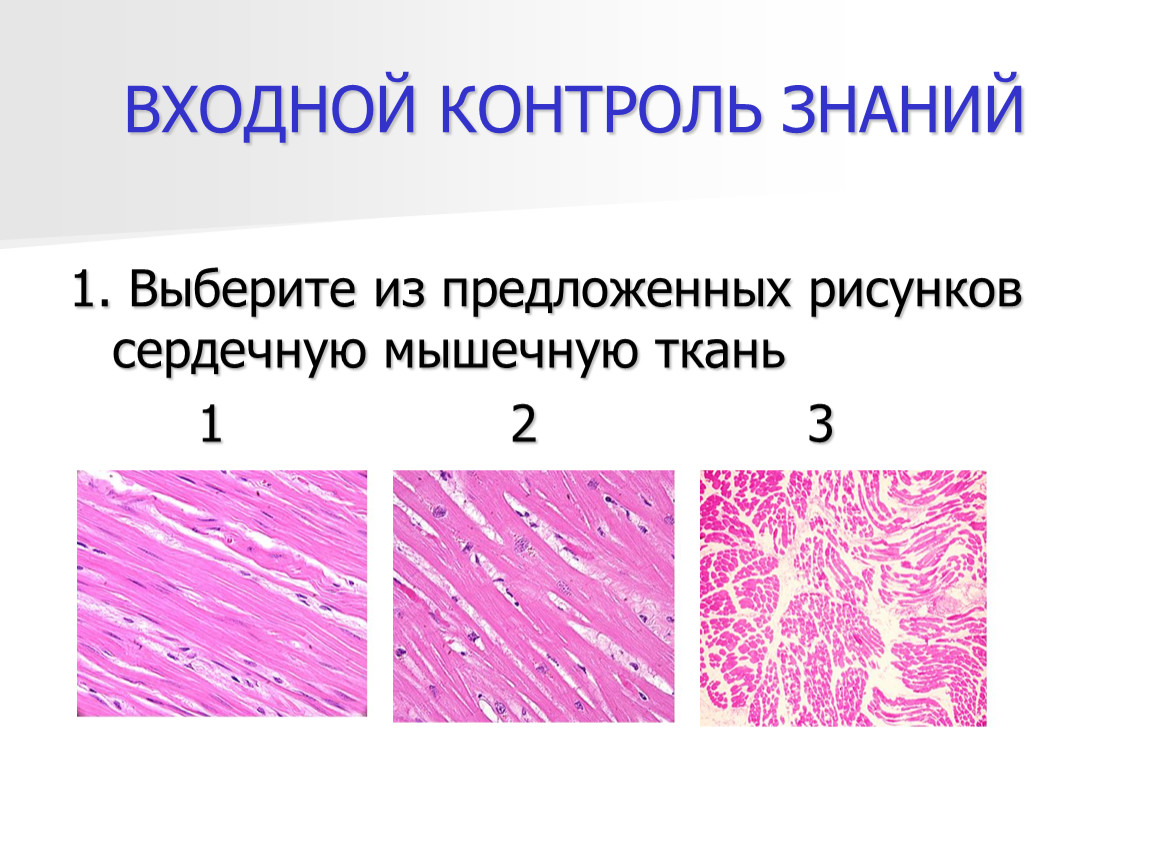 Рисунок сердечная ткань