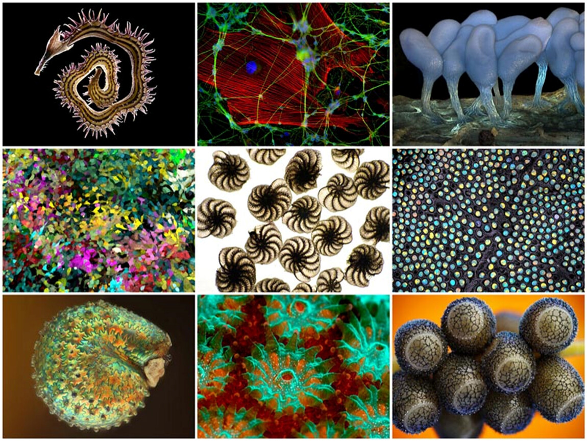 Искусственно созданные организмы. Микромир бактерии. Под микроскопом. Микромир под микроскопом. Бактерии под микроскопом.