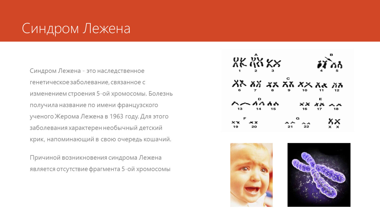 Синдром презентация. Синдром лежёна презентация. Синдрос лёжена картинки для презентации.