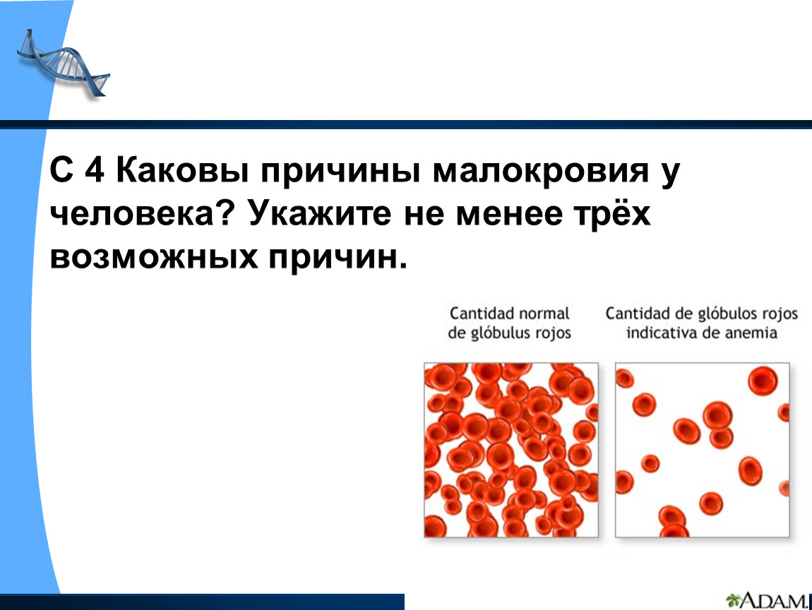 3 возможные. Причины малокровия у человека. Каковы причины малокровия. Какова из причин малокровия у человека. Каковы причины малокровия у человека укажите не.