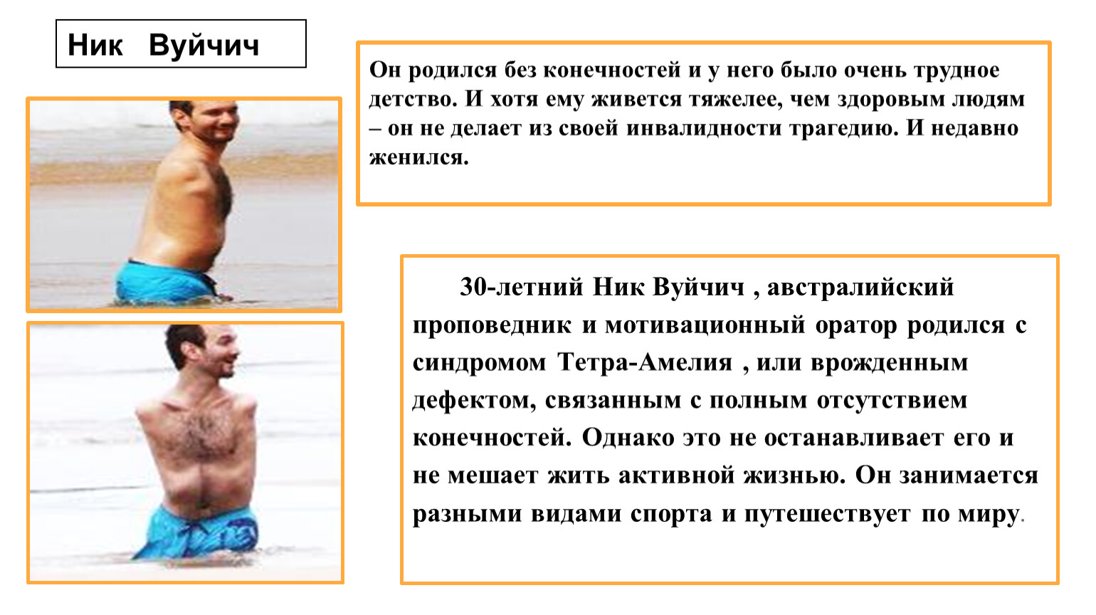 Родился без. Почему люди рождаются без конечностей. Инвалидность трагедия. Рассказ р человеке который родился без конечностей.