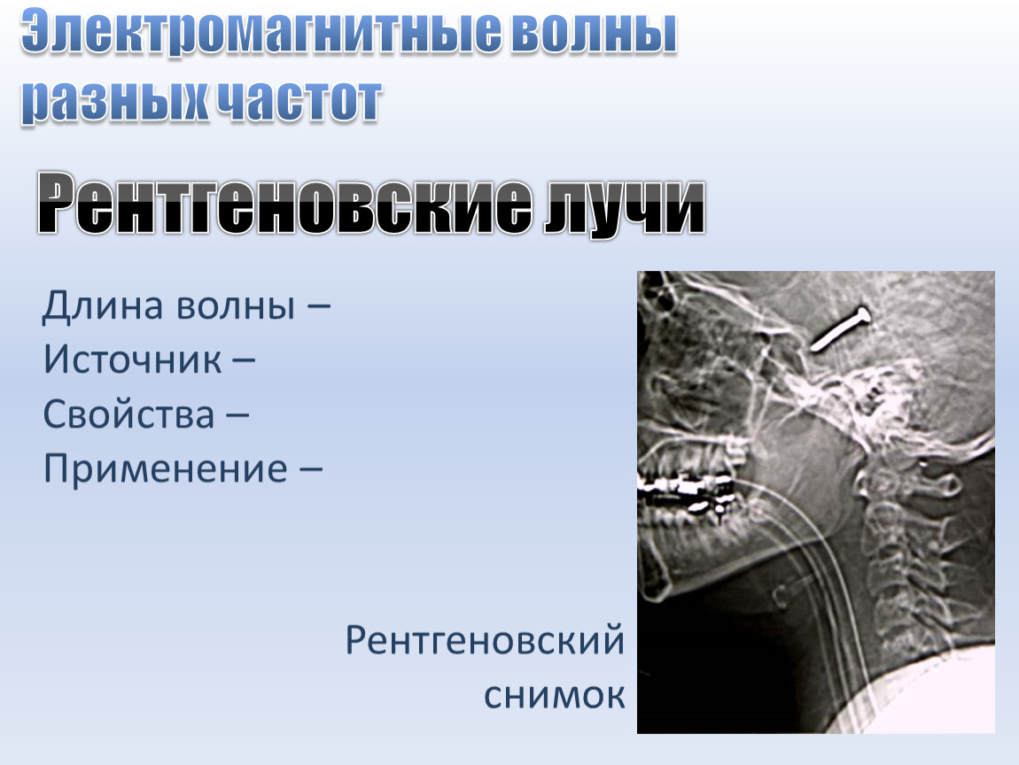 Рентгеновское излучение источник волн. Рентгеновские волны применение.